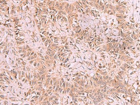 RRP8 Polyclonal Antibody Reactivity Human