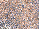 GALK2 Polyclonal Antibody Reactivity Human