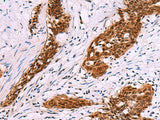 FKBP4 Polyclonal Antibody Reactivity Human
