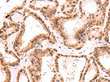 TOR1AIP1 Polyclonal Antibody Reactivity Human