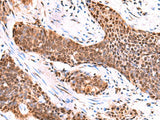 TSEN2 Polyclonal Antibody Reactivity Human