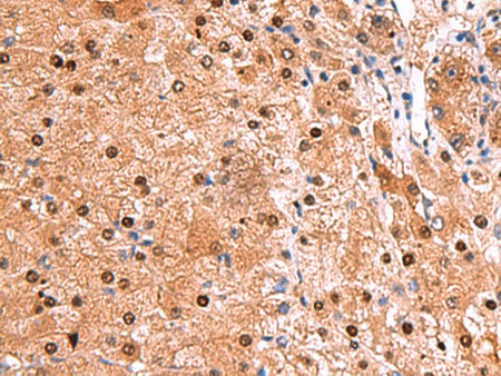 TSEN2 Polyclonal Antibody Reactivity Human