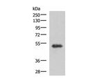 TSEN2 Polyclonal Antibody Reactivity Human