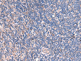 MPP1 Polyclonal Antibody Reactivity Human