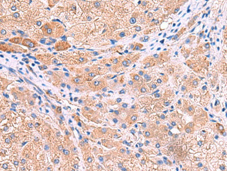 MPP1 Polyclonal Antibody Reactivity Human