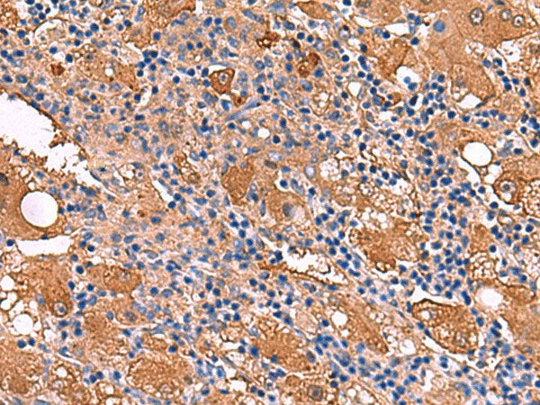FUCA2 Polyclonal Antibody Reactivity Human