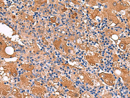 FUCA2 Polyclonal Antibody Reactivity Human