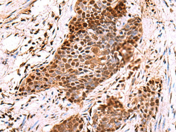 POLD2 Polyclonal Antibody Reactivity Human