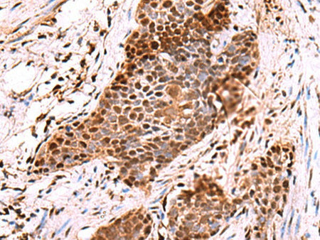 POLD2 Polyclonal Antibody Reactivity Human
