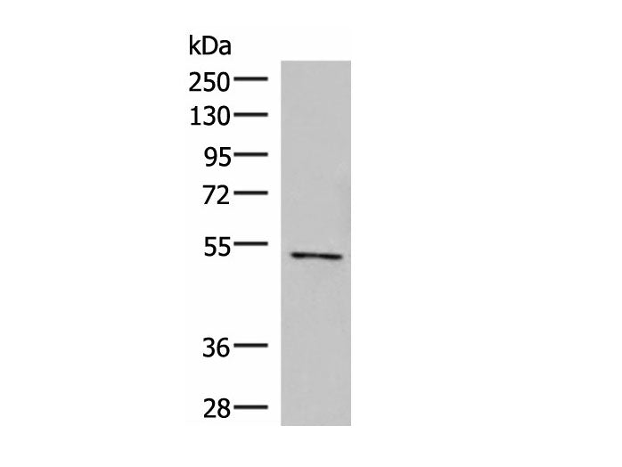 POLD2 Polyclonal Antibody Reactivity Human