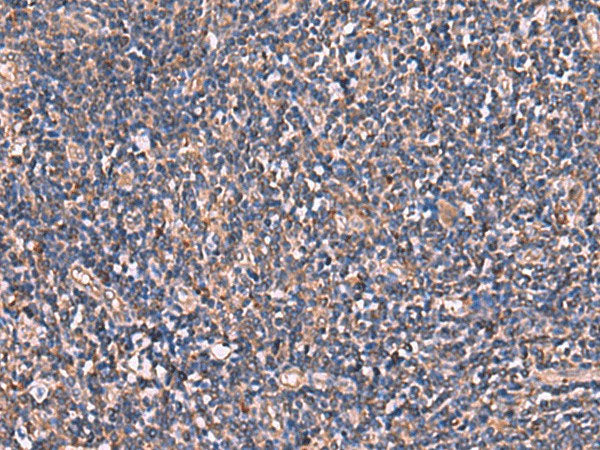 TTC38 Polyclonal Antibody Reactivity Human