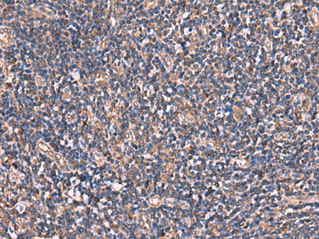 TTC38 Polyclonal Antibody Reactivity Human