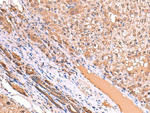 TTC38 Polyclonal Antibody Reactivity Human