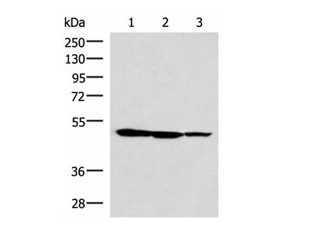 TTC38 Polyclonal Antibody Reactivity Human