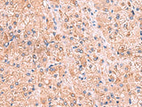 ZNF256 Polyclonal Antibody Reactivity Human