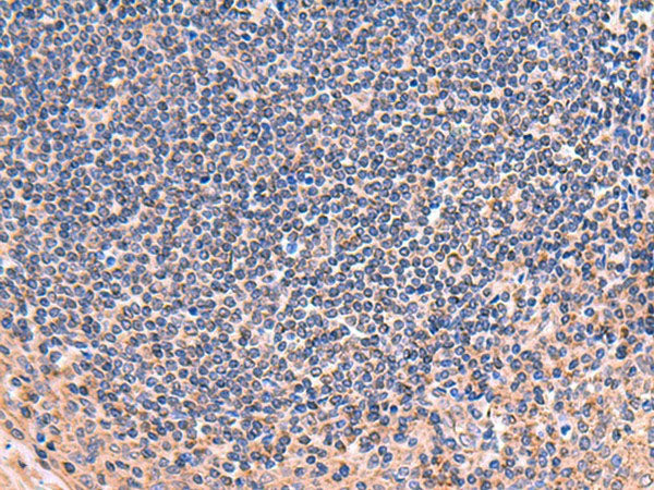 ZNF256 Polyclonal Antibody Reactivity Human