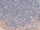 ZNF256 Polyclonal Antibody Reactivity Human