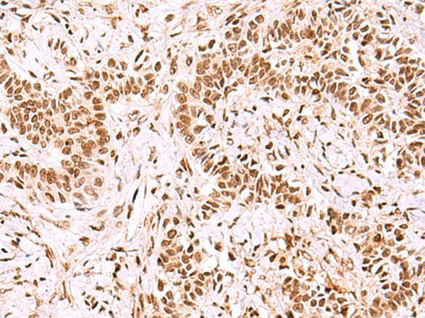 GPKOW Polyclonal Antibody Reactivity Human