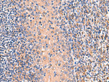 OSBPL2 Polyclonal Antibody Reactivity Human