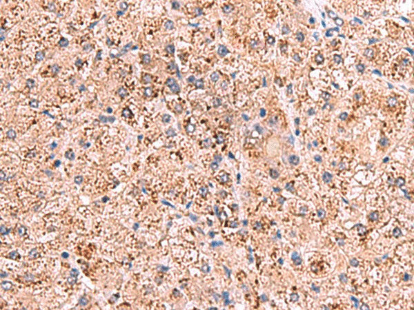 OSBPL2 Polyclonal Antibody Reactivity Human