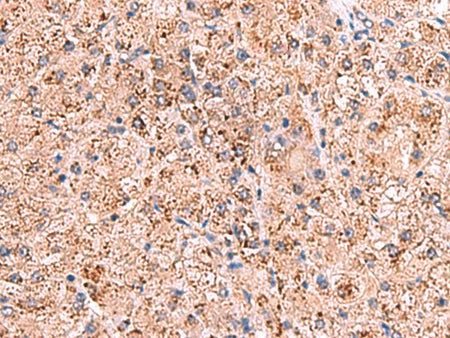 OSBPL2 Polyclonal Antibody Reactivity Human