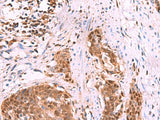 KATNAL1 Polyclonal Antibody Reactivity Human