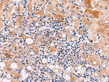 KATNAL1 Polyclonal Antibody Reactivity Human