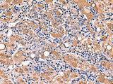 FDXR Polyclonal Antibody Reactivity Human