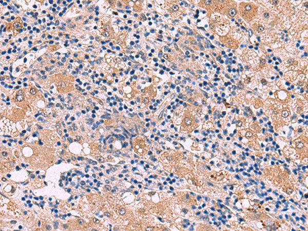 PEPD Polyclonal Antibody Reactivity Human