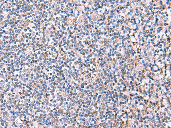 PEPD Polyclonal Antibody Reactivity Human