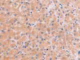 ZAP70 Polyclonal Antibody Reactivity Human