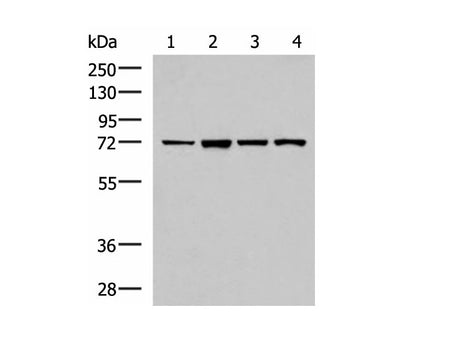 ZAP70 Polyclonal Antibody Reactivity Human