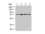 ZAP70 Polyclonal Antibody Reactivity Human