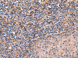 ARIH2 Polyclonal Antibody Reactivity Human