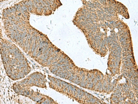 CDC20 Polyclonal Antibody Reactivity Human