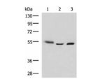 IKZF2 Polyclonal Antibody Reactivity Human