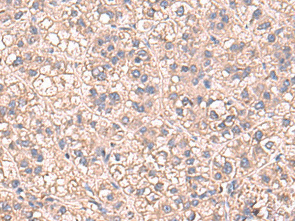 SARS Polyclonal Antibody Reactivity Human