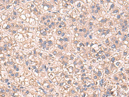 SARS Polyclonal Antibody Reactivity Human