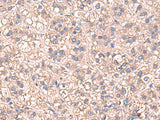 SARS Polyclonal Antibody Reactivity Human