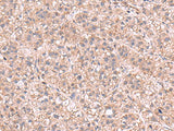 KPNA2 Polyclonal Antibody Reactivity Human