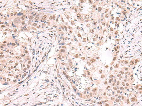 ZNF559 Polyclonal Antibody