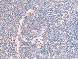 CCT5 Polyclonal Antibody Reactivity Human