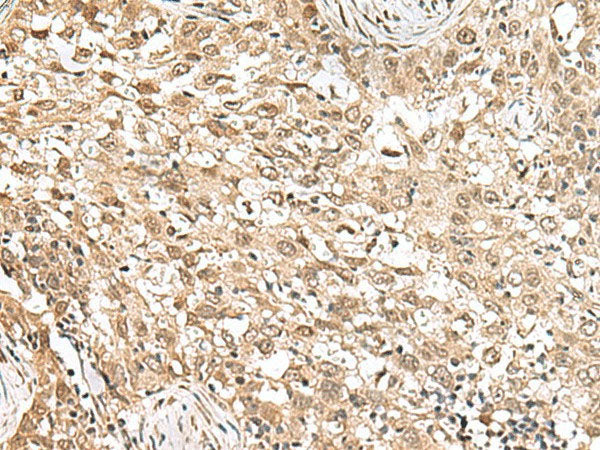 RPS6KA5 Polyclonal Antibody Reactivity Human