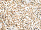 RPS6KA5 Polyclonal Antibody Reactivity Human