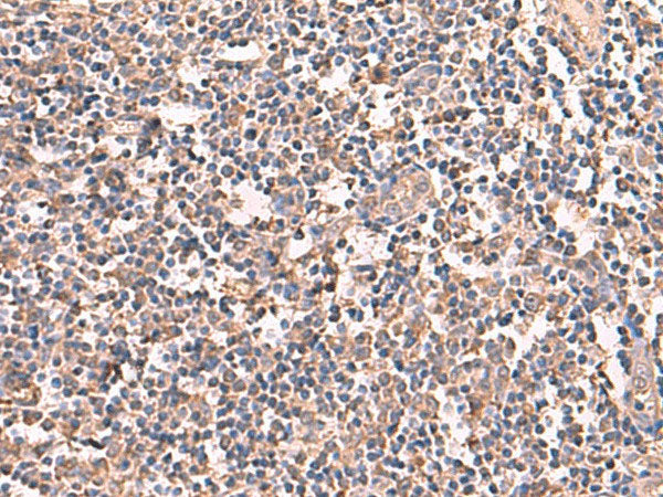 RIOK1 Polyclonal Antibody Reactivity Human