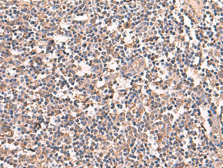 RIOK1 Polyclonal Antibody Reactivity Human