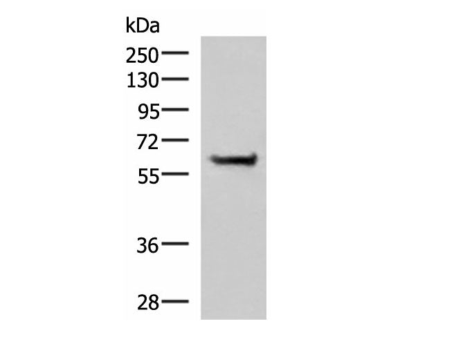 PPP2R1A Polyclonal Antibody Reactivity Human