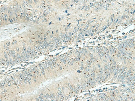DENND6A Polyclonal Antibody