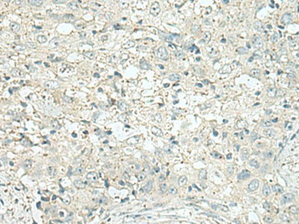 DENND6A Polyclonal Antibody