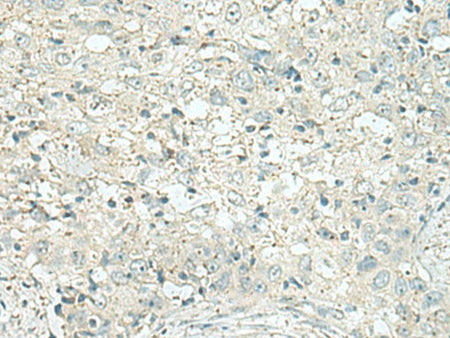 DENND6A Polyclonal Antibody